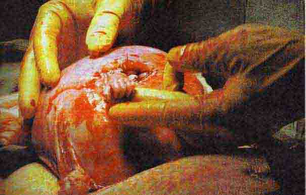 hand_of_hope